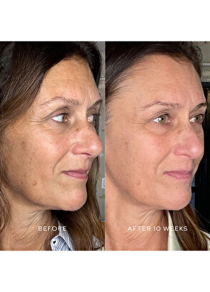 Westman Atelier Suprême C Vitamin C Concentrate - 8