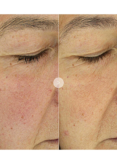 Noble Panacea The Brilliant Glow Hydration Oil 30 Dose - 5