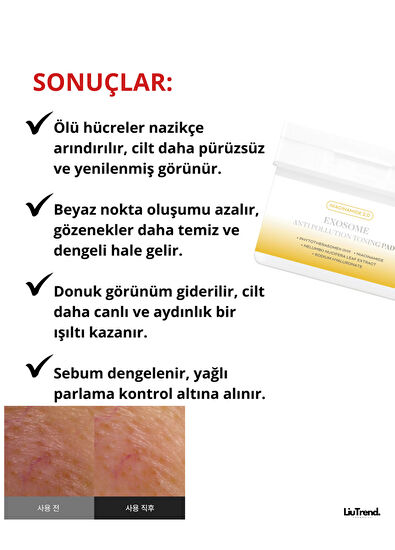 Apothe Exosome Anti-Pollution Toning Pad Gözenek Arındırmaya Yardımcı Aydınlatıcı Ped  Maske 170 ml  - 4
