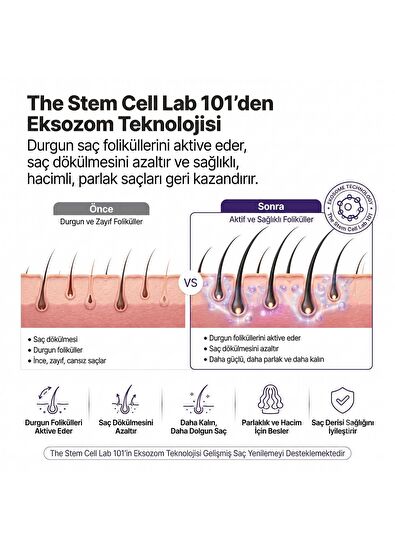 The Stem Cell Lab 101 Hair Shampoo Eksozom ile Zenginleştirilmiş Saç Dökülme Karşıtı Şampuan 340 ml - 3