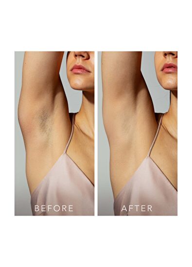 Foreo Peach 2 Ipl Mint Hair Removal Device - 5