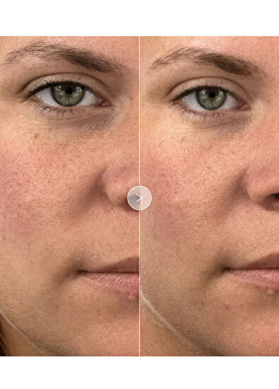 Noble Panacea Brilliant Radiant Resilience Moisturizer Refill - 5