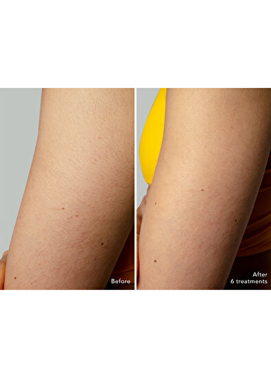 Foreo Peach 2 Go Arctic Blue - 5