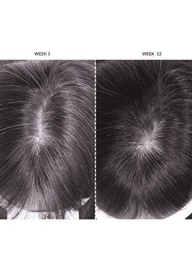 CurrentBody Skin LED Orta Boy Saç Geliştirici Bakım Cihazı - 7