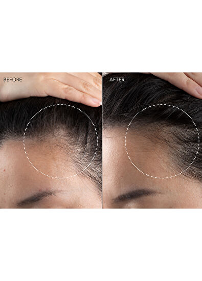 Foreo Faq 301 Led Scalp Massager - 5