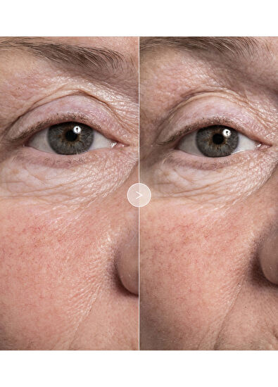 Noble Panacea The Exceptional Eye Lift 12 Dose Refill - 5