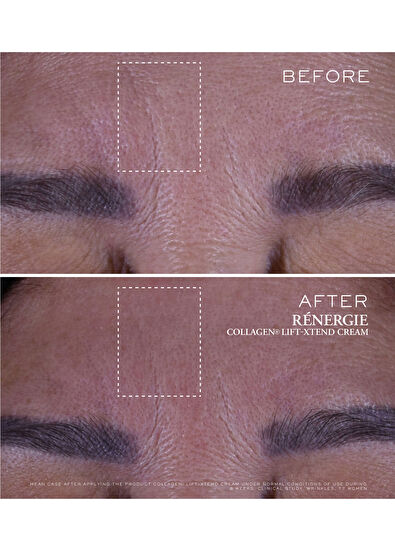 Lancome Rénergie Kolajen Krem - 7