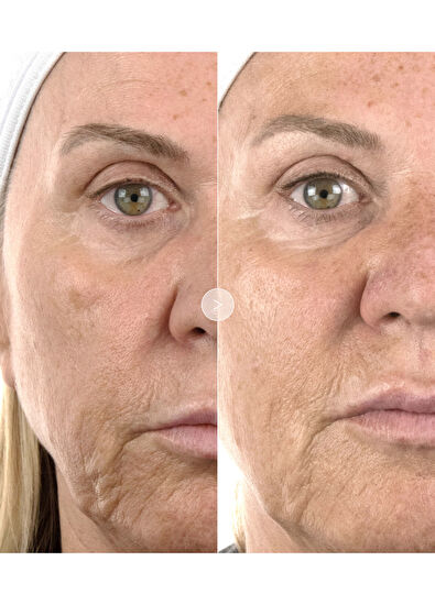 Noble Panacea The Absolute Intense Renewal Serum 30 Dose - 5