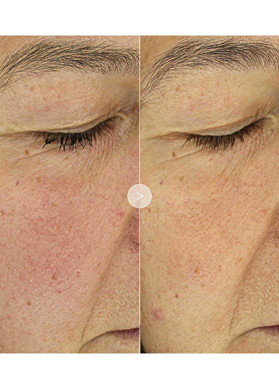 Noble Panacea The Brilliant Glow Hydration Oil 30 Dose REFILL - 5