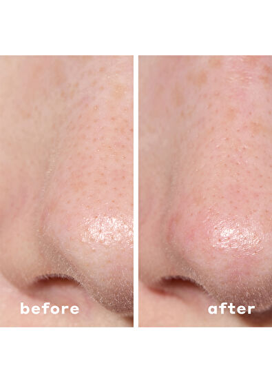 Mario Badescu 2-İn-1 Deep Cleansing Pore Strips 6 Patches - 6