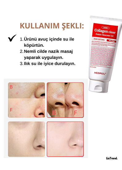 MEDIPEEL Red Lacto Collagen Clear Foam Cleanser 2.0 Facial Cleansing Foam Containing Collagen and Probiotics 300 ml - 5