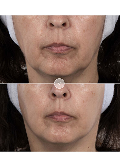 Noble Panacea The Exceptional Chronobiology Sleep Mask 8 Dose - 5