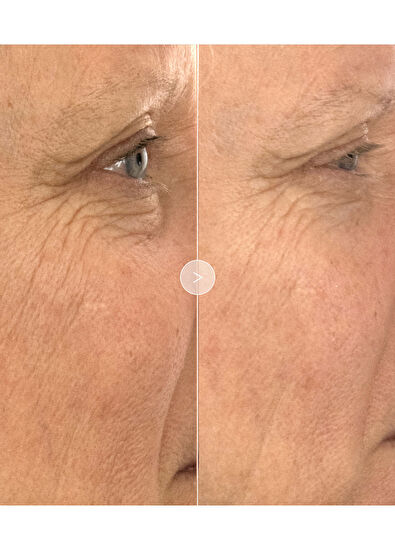 Noble Panacea The Absolute Restoring Eye Cream 30 Dose - 5