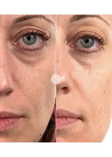 Noble Panacea The Brilliant Prime Radiance Serum 30 Dose - 5