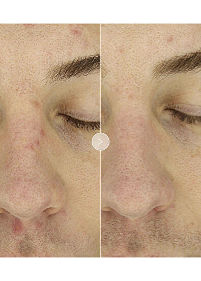 Noble Panacea The Exceptional Overnight Chronobiology Peel 8 Dos - 5