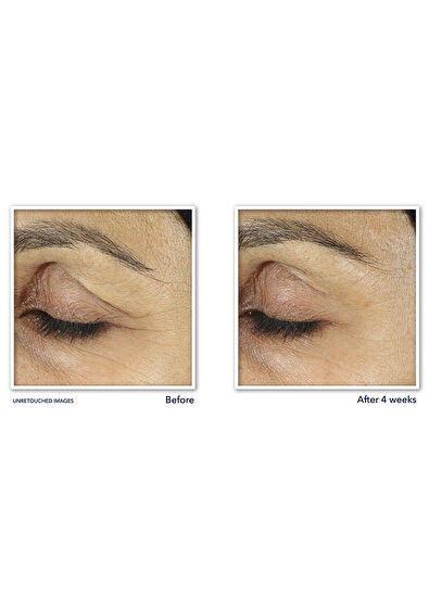 Roc Line Smoothing Kırışıklık Karşıtı Canlandırıcı Göz Kremi 15 ml - 6