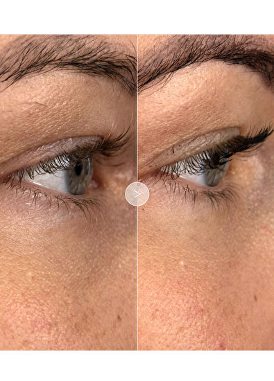 Noble Panacea The Brilliant Vibrant Eye Infusion 30 Dose Refill - 5