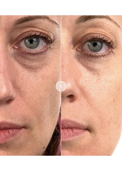 Noble Panacea The Brilliant Prime Radiance Serum 30 Dose Refill - 5