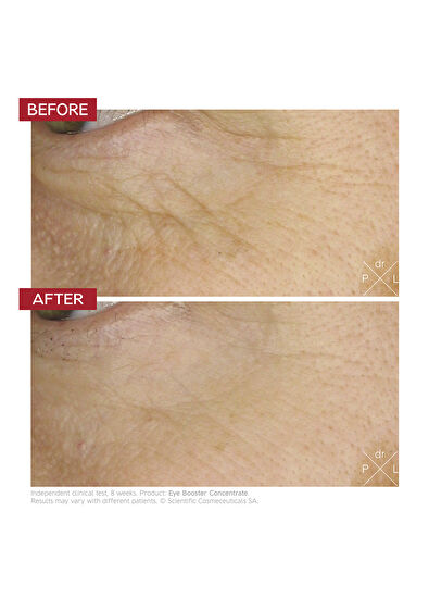 Dr.Levy Eye Booster Concentrate 5 ML - 5