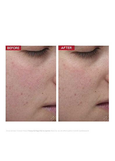 Dr.Levy Freezing Anti-Fatigue Mask 30 ML - 4