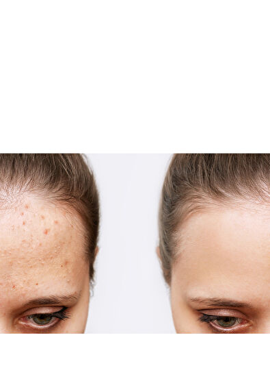 Foreo ESPADA 2 Plus Pistachio - 5