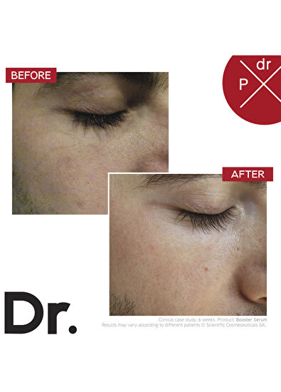 Dr.Levy Booster Serum 30 ml - 5