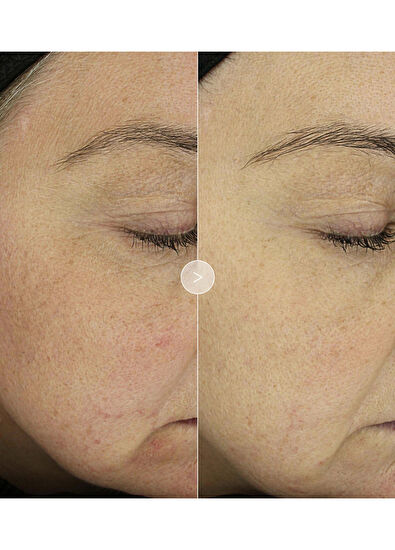 Noble Panacea The Absolute Nourishing Lift Oil 30 Dose - 5