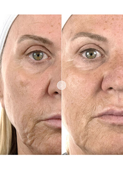 Noble Panacea The Absolute Intense Renewal Serum 30 Dose REFILL - 5