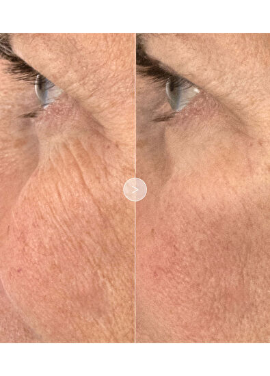 Noble Panacea The Absolute Rejuvenation Night Balm 30 Dose REFIL - 5