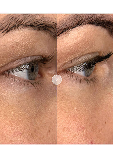 Noble Panacea The Brilliant Vibrant Eye Infusion 30 Dose - 5