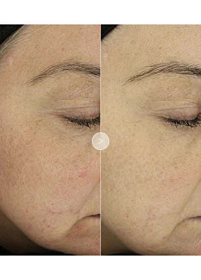 Noble Panacea The Absolute Nourishing Lift Oil 30 Dose REFILL - 5