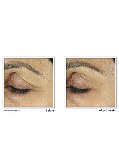 Roc Line Smoothing Kırışıklık Karşıtı Canlandırıcı Göz Kremi 15 ml - 6