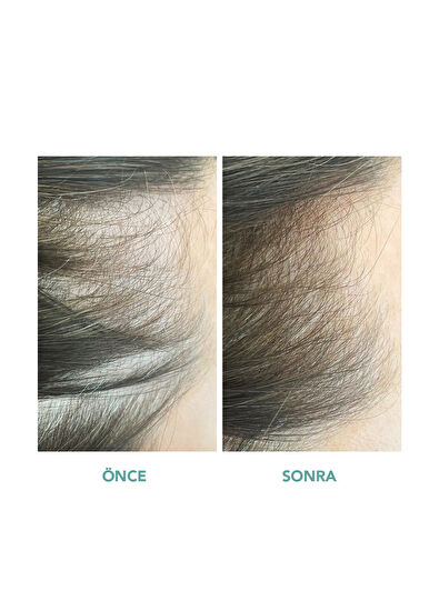 We Are Paradoxx Growth Thickening 250 ml Saç Kremi - 3