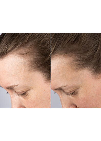 CurrentBody Skin LED Orta Boy Saç Geliştirici Bakım Cihazı - 6