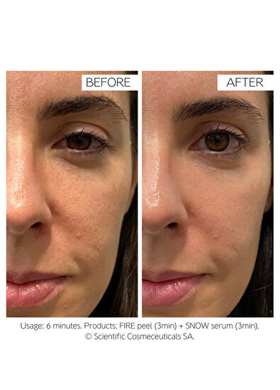 Dr.Levy Fire & Snow - 4