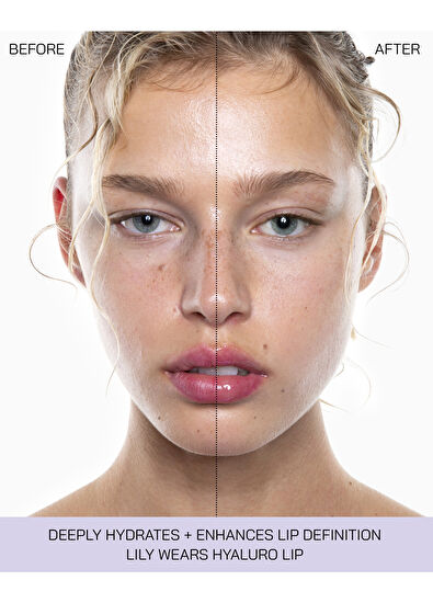 Isamaya Hyalurolip - Lucient - 7