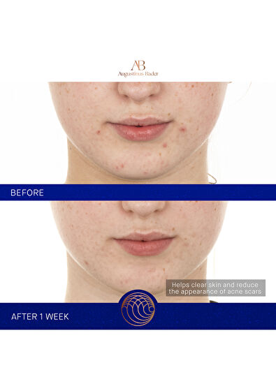 Augustinus Bader The Retinol Serum 15ml - 6