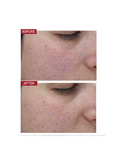 Dr.Levy Freezing Anti-Fatigue Mask 30 ML - 5