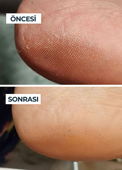 Voesh New York Solemate Heel Repair Balm 22 ml - 4