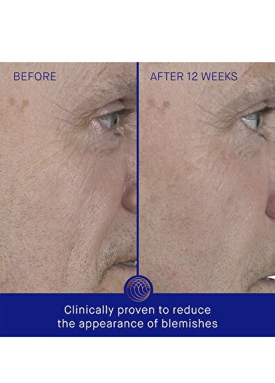 Augustinus Bader Yüz Bakım Serumu 50 ml - 7