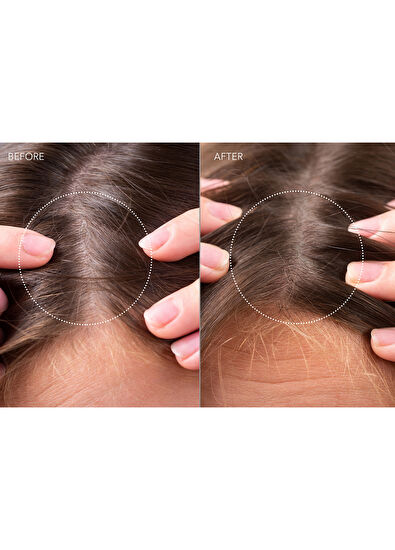 Foreo Faq 302 Laser And Led Scalp Massager - 5