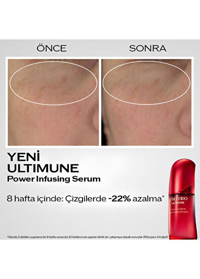 Shiseido Ultimune 4.0 Power İnfusing Serum 120 ml - 5