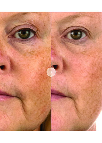 Noble Panacea The Absolute Active Replenishing Moisturizer 30 Do - 5