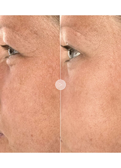 Noble Panacea The Brilliant Overnight Recharge Cream 30 Dose - 5