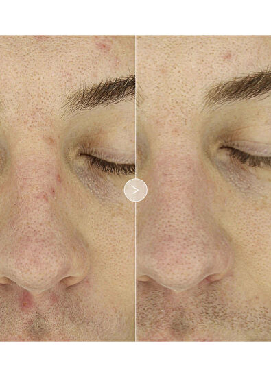 Noble Panacea The Exceptional Overnight Chronobiology Peel 8 Dos - 5