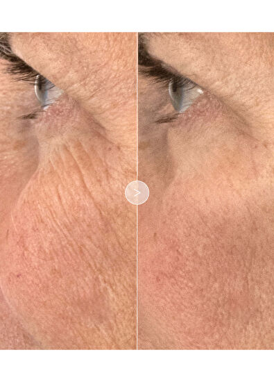 Noble Panacea The Absolute Rejuvenation Night Balm 30 Dose - 5