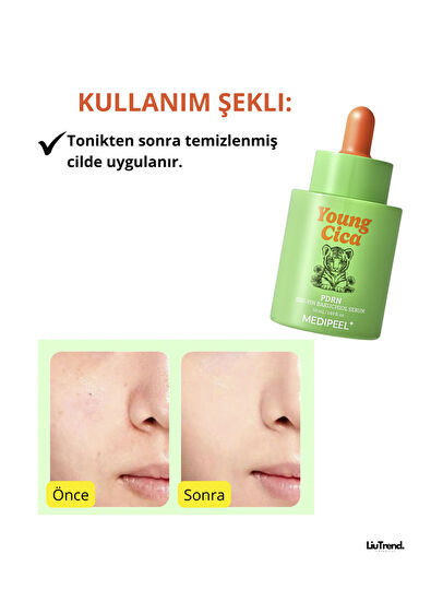 MEDIPEEL Young Cica PDRN Exo-Pin Bakuchiol Serum PDRN ve Bakuchiol İçeren Sıkılaştırıcı Cilt Serumu 50 ml  - 4