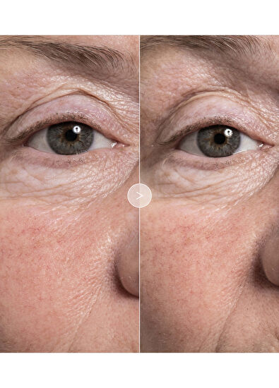 Noble Panacea The Exceptional Eye Lift 12 Dose - 5