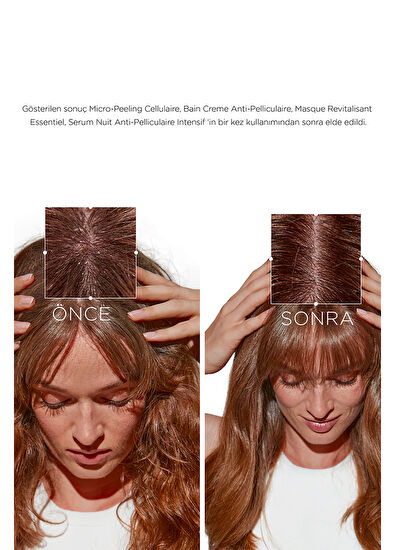 Kerastase Symbiose Kepek Karşıtı Saçın Kolay Açılmasını Sağlayan Yatıştırıcı Hücresel Saç Kremi 200 ml - 5