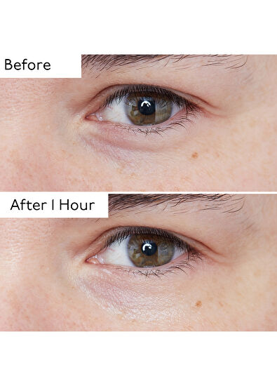 By Terry Hyaluronic Global Eye Serum 15 ml - 4